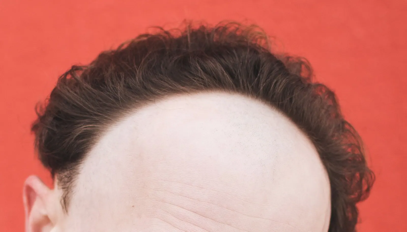 Image d’exemple du front et de la ligne frontale (yeux hors cadre)